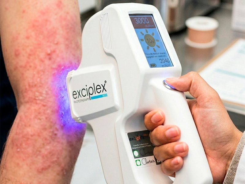 page-procedimientos-dermatologicos-dermatitis-atopica-banner-3