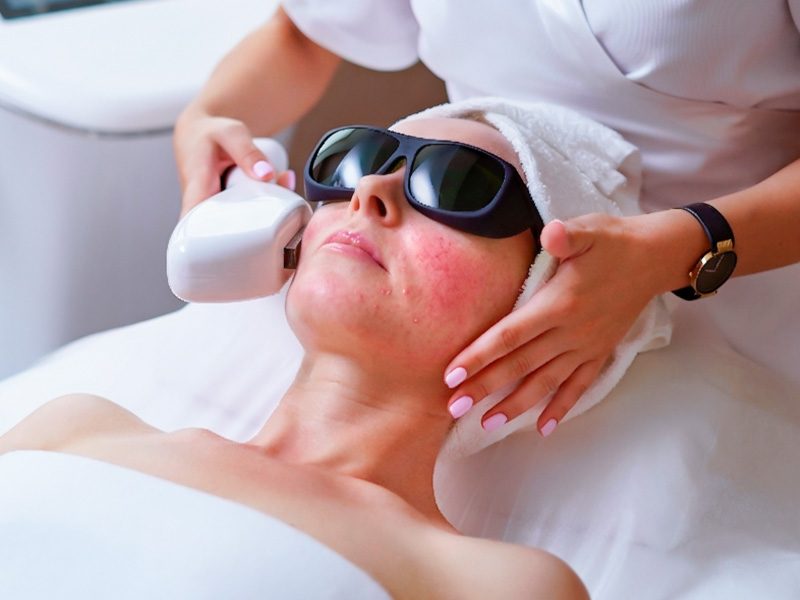page-procedimientos-dermatologicos-rosacea-banner-3