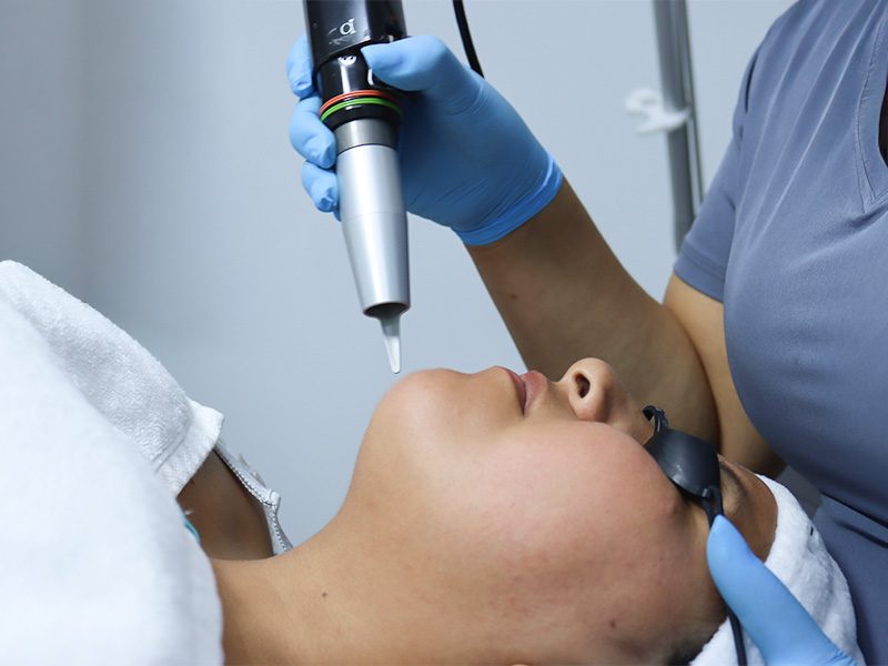 page-procedimientos-esteticos-depilacion-facial-banner-3