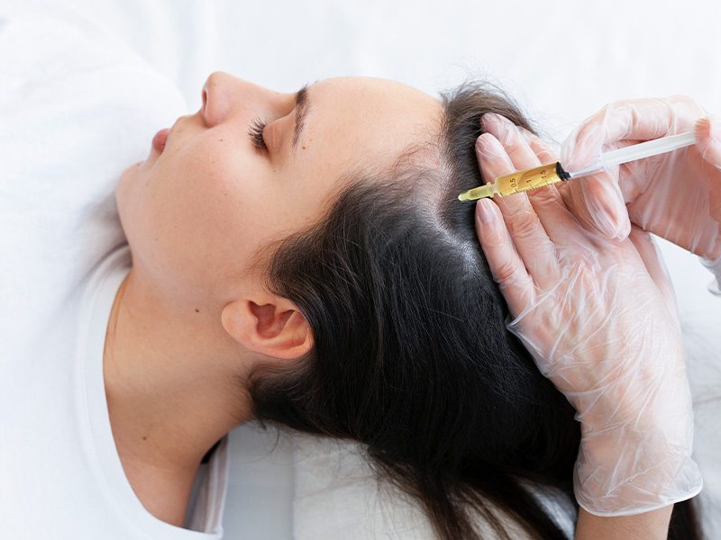 page-procedimientos-esteticos-mesoterapia-capilar-banner-1