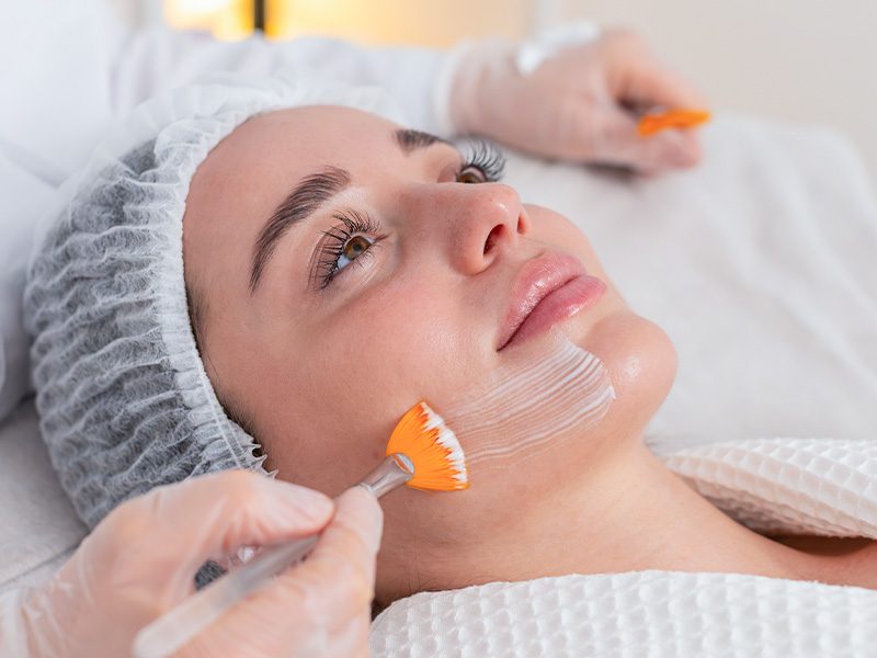 page-procedimientos-esteticos-peeling-facial-banner-3