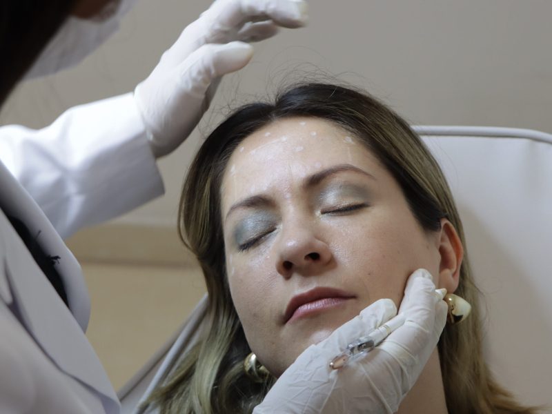 toxina-botulinica-preparacion-vinali