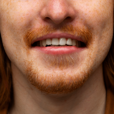 hombre_triste_sin_coctel_vinali_centro_derma